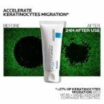 IRRITATED SKIN - Image 3